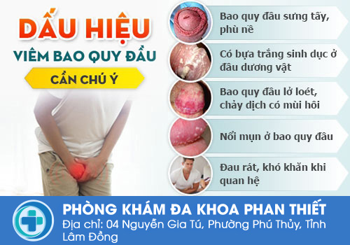 Ngứa vùng kín ở nam giới do viêm bao quy đầu