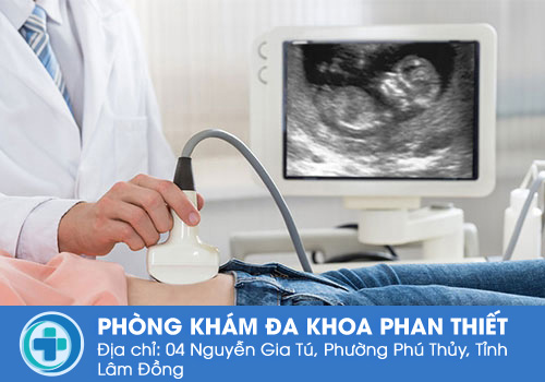 Siêu âm thai là gì? Giải đáp các vấn đề về siêu âm thai