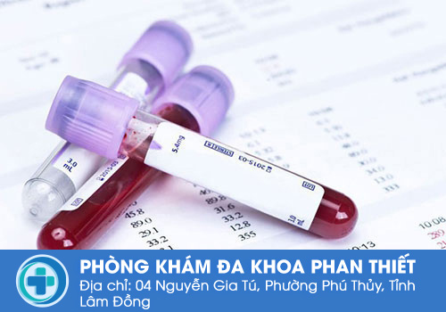 Xét nghiệm tổng quát máu cần lưu ý những gì?