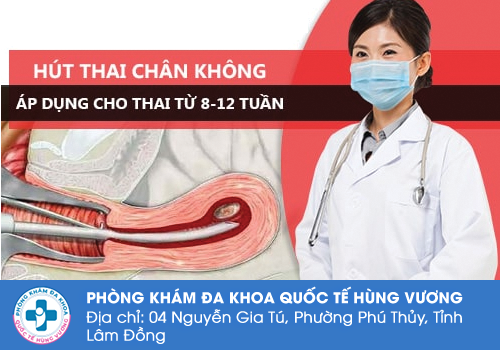 Cách bỏ thai an toàn bằng phương pháp hút thai chân không