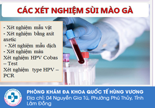 Các phương pháp xét nghiệm sùi mào gà chính xác hiện nay