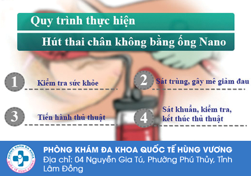 Phá thai ngoại khoa