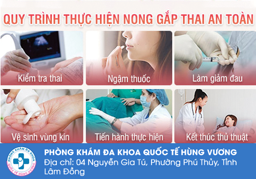 Cách phá thai an toàn bằng phẫu thuật