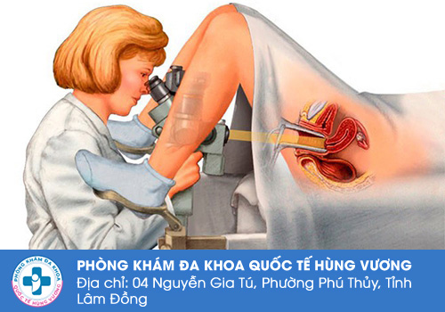 Soi cổ tử cung là gì?