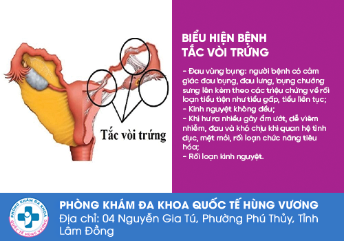 Các bệnh vùng kín nữ giới thường gặp phải 