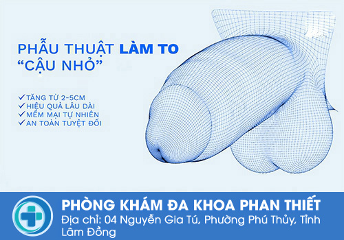 Phẫu thuật tăng kích thước cậu nhỏ là gì?