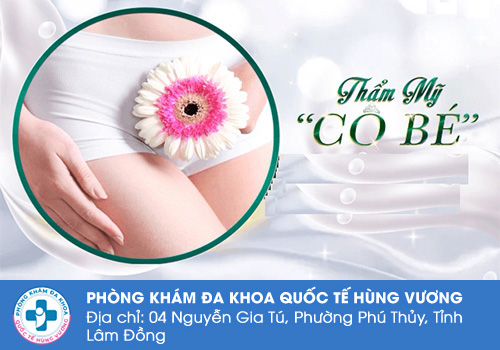 Chỉnh âm đạo là gì?
