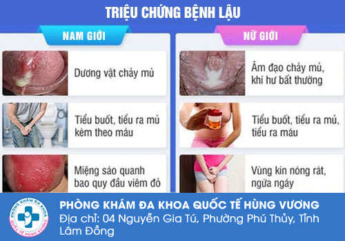 Đi tiểu buốt có mủ ở nam giới là bệnh gì?