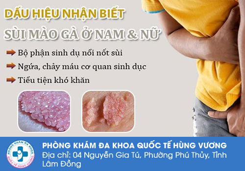 Nổi mụn nước vùng kín do bệnh sùi mào gà