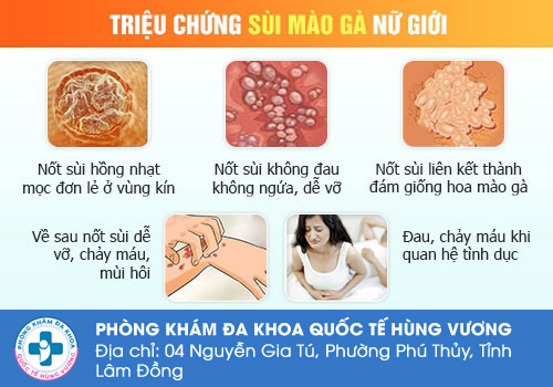 Triệu chứng sùi mào gà ở nữ giới