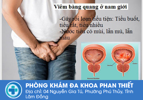 Những dấu hiệu và triệu chứng bệnh viêm bàng quang ở nam giới