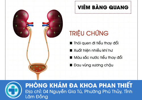 Triệu chứng viêm bàng quang