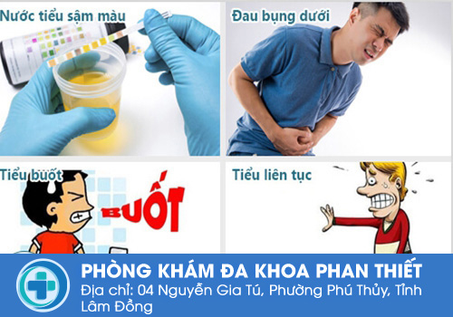 Khám viêm đường tiết niệu hết bao nhiêu tiền?