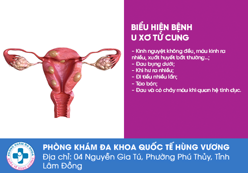 Các bệnh vùng kín nữ giới thường gặp phải
