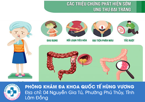 Đi cầu ra máu đỏ tươi do ung thư đại tràng