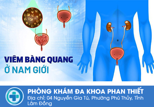 Nguyên nhân gây ra viêm bàng quang