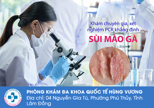 Xét nghiệm sùi mào gà bao nhiêu tiền?
