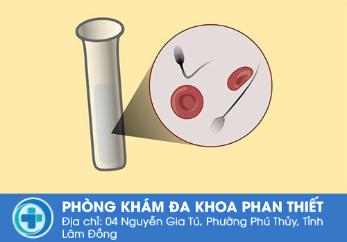 Tác hại của xuất tinh ra máu